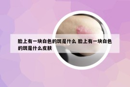 脸上有一块白色的斑是什么 脸上有一块白色的斑是什么皮肤