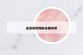 应该如何预防白癜风啊