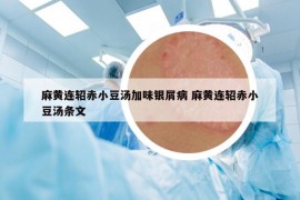 麻黄连轺赤小豆汤加味银屑病 麻黄连轺赤小豆汤条文
