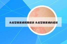 头皮型银屑病初期症状 头皮型银屑病的症状