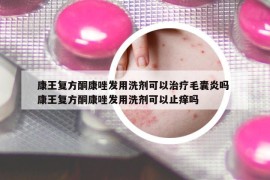 康王复方酮康唑发用洗剂可以治疗毛囊炎吗 康王复方酮康唑发用洗剂可以止痒吗