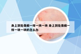 身上到处像癣一样一块一块 身上到处像癣一样一块一块的怎么办