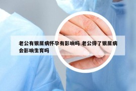 老公有银屑病怀孕有影响吗 老公得了银屑病会影响生育吗
