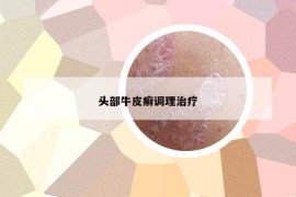 头部牛皮癣调理治疗