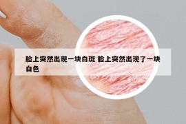 脸上突然出现一块白斑 脸上突然出现了一块白色