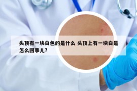 头顶有一块白色的是什么 头顶上有一块白是怎么回事儿?