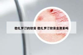 他扎罗汀的软膏 他扎罗汀软膏含激素吗