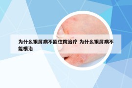 为什么银屑病不能住院治疗 为什么银屑病不能根治