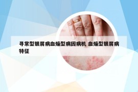 寻常型银屑病血燥型病因病机 血燥型银屑病特征