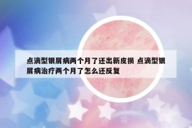 点滴型银屑病两个月了还出新皮损 点滴型银屑病治疗两个月了怎么还反复