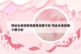 阿达木单抗和司库奇尤哪个好 阿达木单抗哪个牌子好