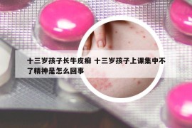 十三岁孩子长牛皮癣 十三岁孩子上课集中不了精神是怎么回事