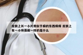 皮肤上长一小片类似于癣的东西痒痒 皮肤上有一小块像癣一样的是什么