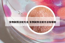 生物制剂注射方法 生物制剂注射方法有哪些