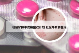 社区铲除牛皮癣整改计划 社区牛皮鲜整治
