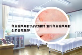 白点癫风用什么药效果好 治疗白点癫风用什么药膏效果好