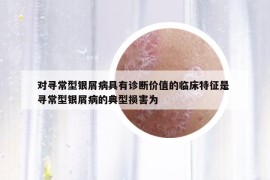 对寻常型银屑病具有诊断价值的临床特征是 寻常型银屑病的典型损害为