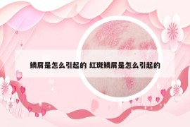 鳞屑是怎么引起的 红斑鳞屑是怎么引起的