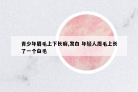 青少年眉毛上下长癣,发白 年轻人眉毛上长了一个白毛