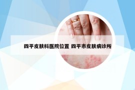 四平皮肤科医院位置 四平市皮肤病诊所