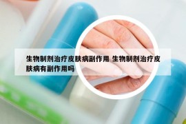 生物制剂治疗皮肤病副作用 生物制剂治疗皮肤病有副作用吗