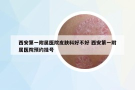 西安第一附属医院皮肤科好不好 西安第一附属医院预约挂号