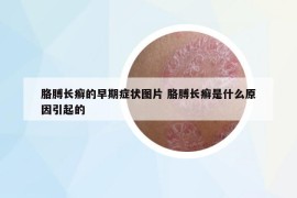 胳膊长癣的早期症状图片 胳膊长癣是什么原因引起的