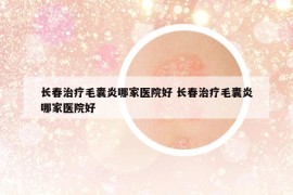 长春治疗毛囊炎哪家医院好 长春治疗毛囊炎哪家医院好