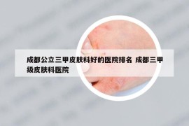 成都公立三甲皮肤科好的医院排名 成都三甲级皮肤科医院
