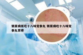 银屑病有吃十八味党参丸 银屑病吃十八味党参丸胃疼