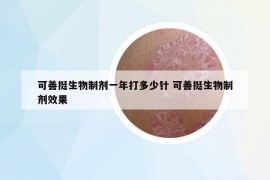 可善挺生物制剂一年打多少针 可善挺生物制剂效果