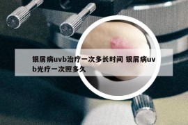 银屑病uvb治疗一次多长时间 银屑病uvb光疗一次照多久