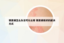 银屑病怎么办法可以止痒 银屑病有好的解决方式