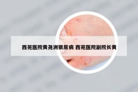 西苑医院黄尧洲银屑病 西苑医院副院长黄