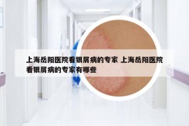 上海岳阳医院看银屑病的专家 上海岳阳医院看银屑病的专家有哪些