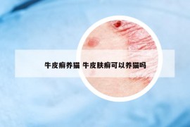 牛皮癣养猫 牛皮肤癣可以养猫吗