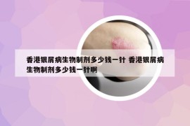 香港银屑病生物制剂多少钱一针 香港银屑病生物制剂多少钱一针啊