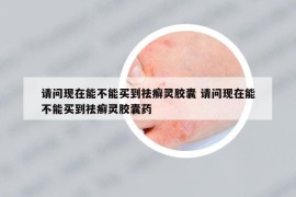 请问现在能不能买到祛癣灵胶囊 请问现在能不能买到祛癣灵胶囊药