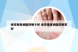 南京银屑病医院哪个好 南京银屑病医院那家好