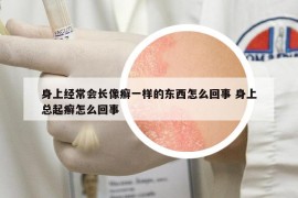 身上经常会长像癣一样的东西怎么回事 身上总起癣怎么回事