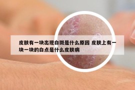 皮肤有一块出现白斑是什么原因 皮肤上有一块一块的白点是什么皮肤病