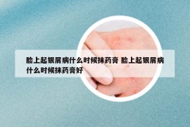 脸上起银屑病什么时候抹药膏 脸上起银屑病什么时候抹药膏好