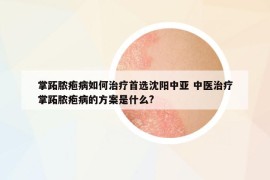 掌跖脓疱病如何治疗首选沈阳中亚 中医治疗掌跖脓疱病的方案是什么?