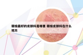 赣榆最好的皮肤科是哪里 赣榆皮肤科在什么地方