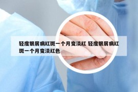 轻度银屑病红斑一个月变淡红 轻度银屑病红斑一个月变淡红色