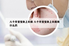 八个月宝宝身上长癣 八个月宝宝身上长癣用什么药