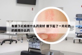 有腋下红癣用什么药膏好 腋下起了一片红色的癣用什么药