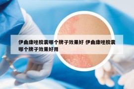 伊曲康唑胶囊哪个牌子效果好 伊曲康唑胶囊哪个牌子效果好用
