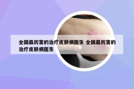全国最厉害的治疗皮肤病医生 全国最厉害的治疗皮肤病医生