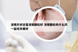 消银片好还是消银颗粒好 消银颗粒和什么药一起吃效果好